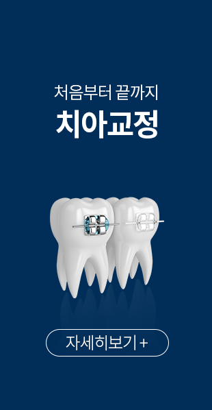 처음부터-끝까지-치아교정-선택됨